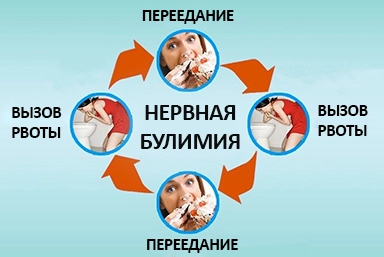 Лечение булимии в Медногорске